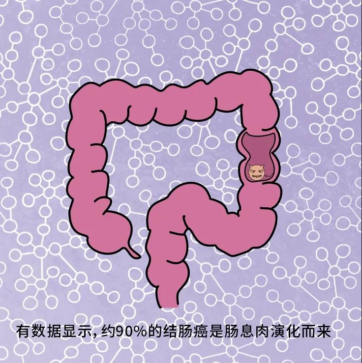 奪走“黑豹”生命的結(jié)腸癌，到底什么來(lái)頭？