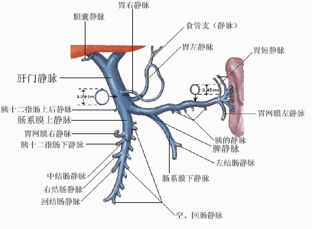 反復(fù)嘔血、黑便怎么辦？TIPS手術(shù)能解決