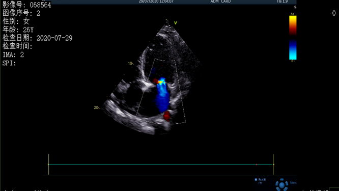 心電圖異常，心臟卻沒事，罪魁禍?zhǔn)资恰?>
				             </a>
                <div   id=