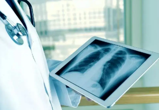 健康呼吸④體檢發(fā)現(xiàn)肺結(jié)節(jié)，我該怎么辦？