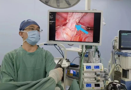 30歲小伙持續(xù)發(fā)燒咳嗽，原來是多長一塊肺......