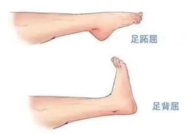 扭胯小連步、動(dòng)感搖花手……“科目三”雖火，運(yùn)動(dòng)損傷也要防！