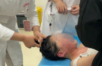 14歲，面、頸、胸燙傷，只因中午那鍋面湯…